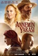 annemin-yarasi